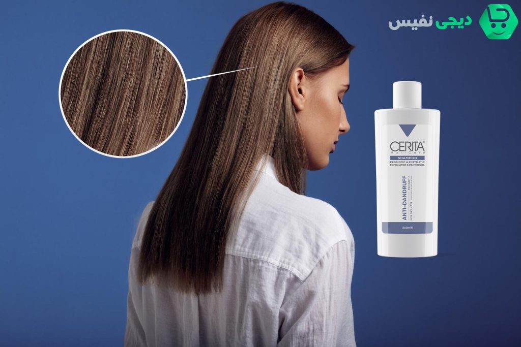 شامپو ضد شوره پروبیوتیک