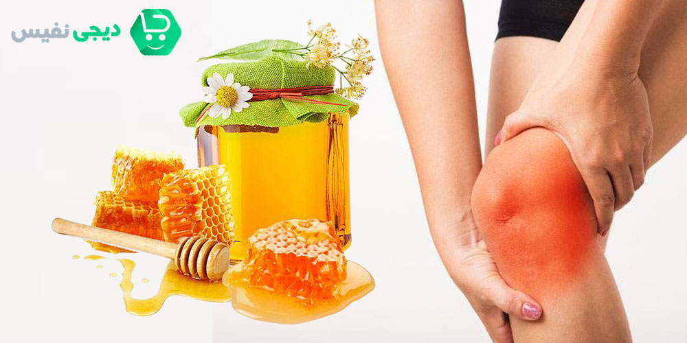 درمان زانو درد با عسل راه حلی شگفت انگیز