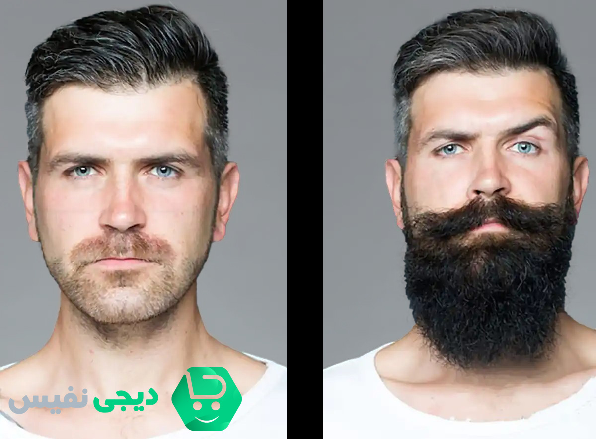 بهترین داروها برای رشد ریش صورت و تقویت آن