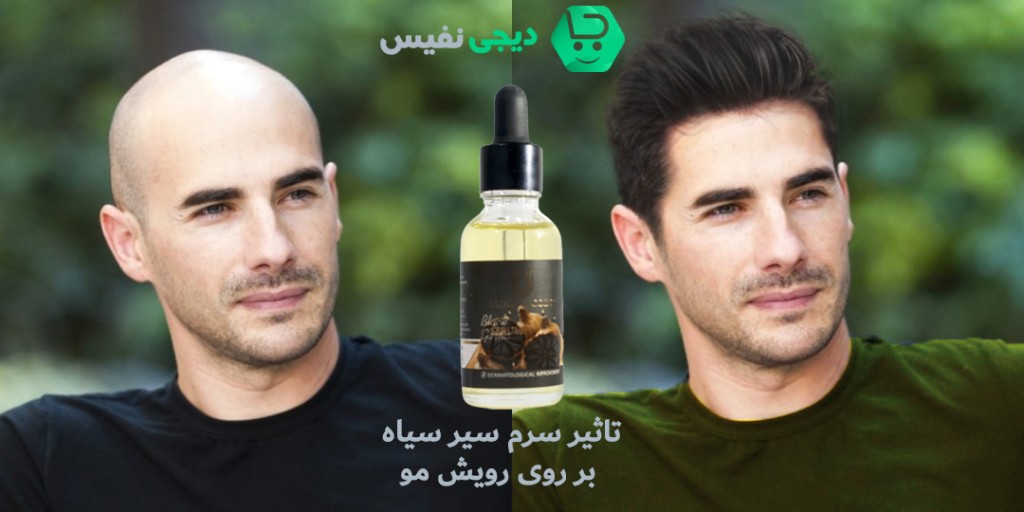 سرم سیر سیاه برای مو