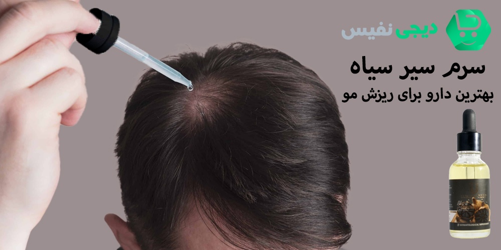 بهترین دارو برای ریزش مو