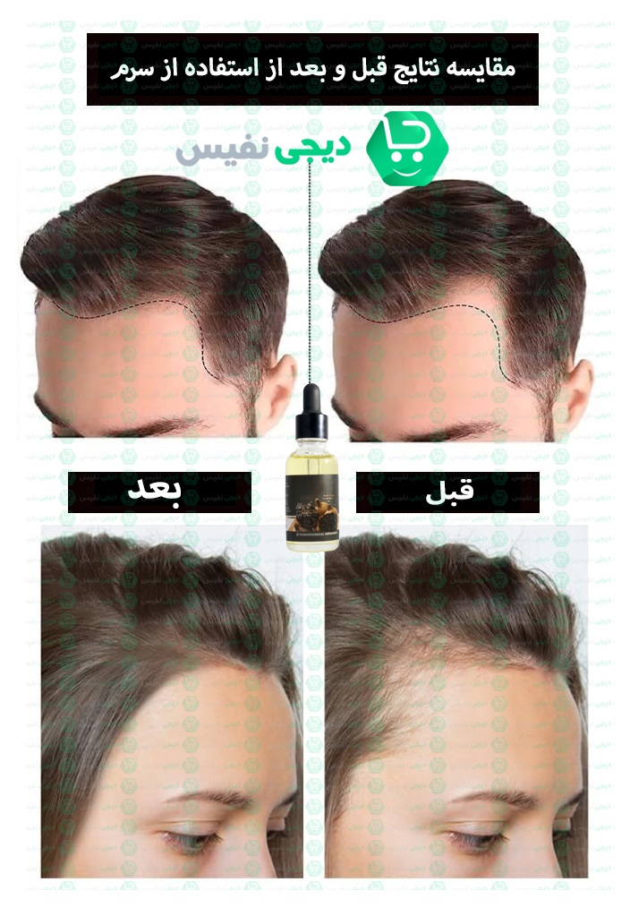 مقایسه نتایج قبل و بعد از استفاده از سرم سیر سیاه