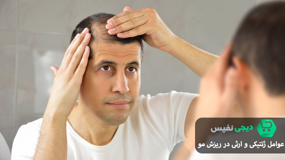 عوامل ژنتیکی و ارثی در ریزش مو
