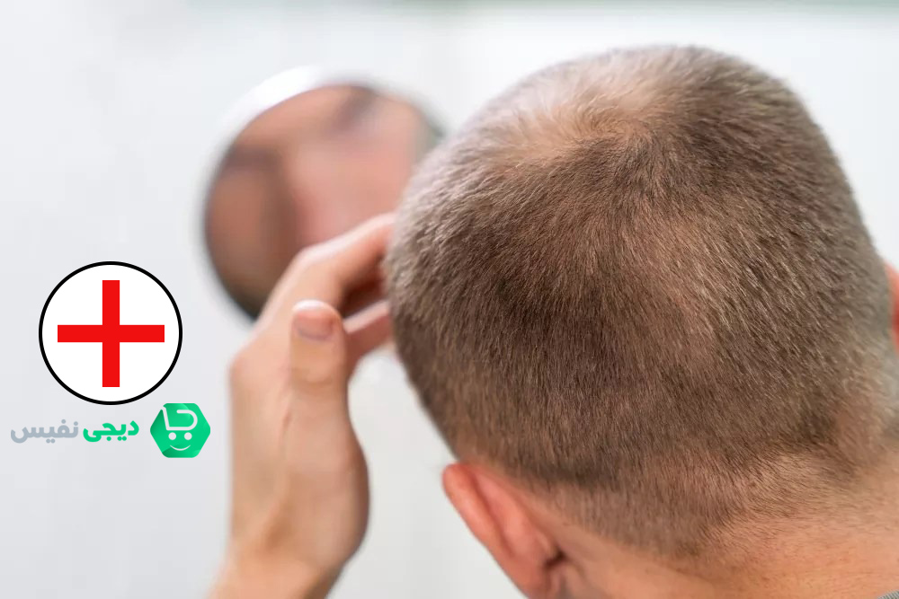 شرایط پزشکی مرتبط با ریزش مو