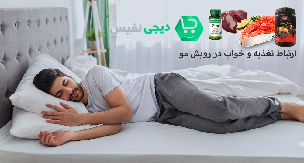 ارتباط تغذیه و خواب در رویش مو