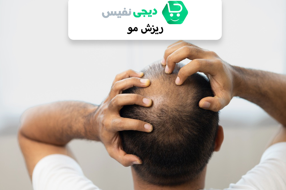 ریزش مو چیست؟