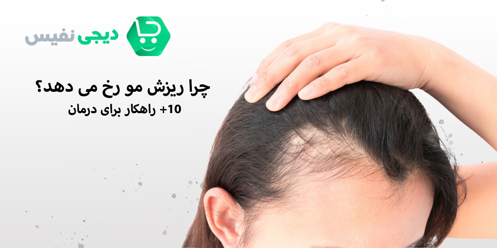 چرا ریزش مو رخ می دهد؟
