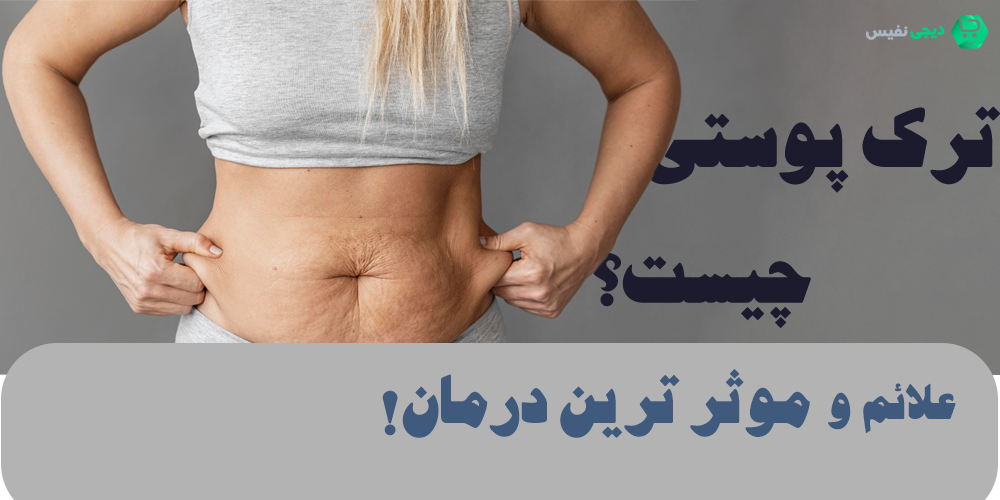 ترک پوستی چیست؟