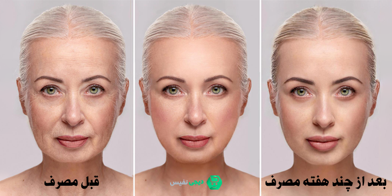 کلاژن چیست و چه تاثیری روی پوست دارد؟