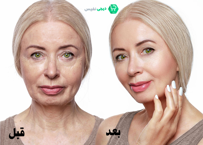 استفاده از کرم گاتیو
