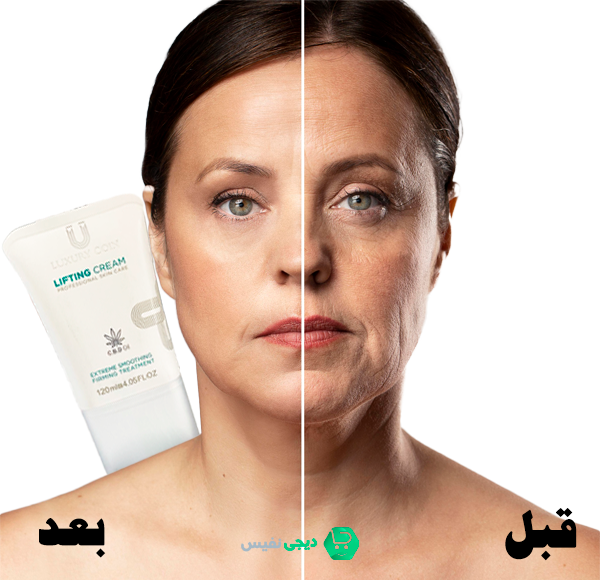 مزایای استفاده از کرم لیفتینگ لاکچری کوین برای صورت