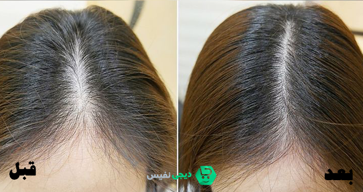 روش مصرف روغن سبوس برنج دکتر بیز