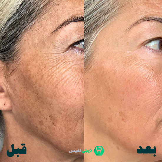 چرا آبرسانی پوست مهم است