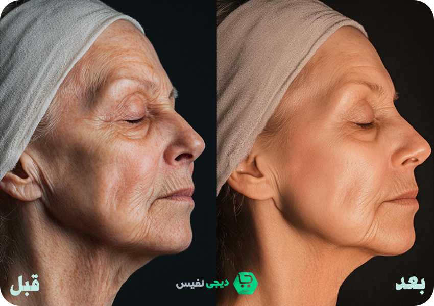 تاثیر سرم ویتامین A لاکچری کوین روی پوست